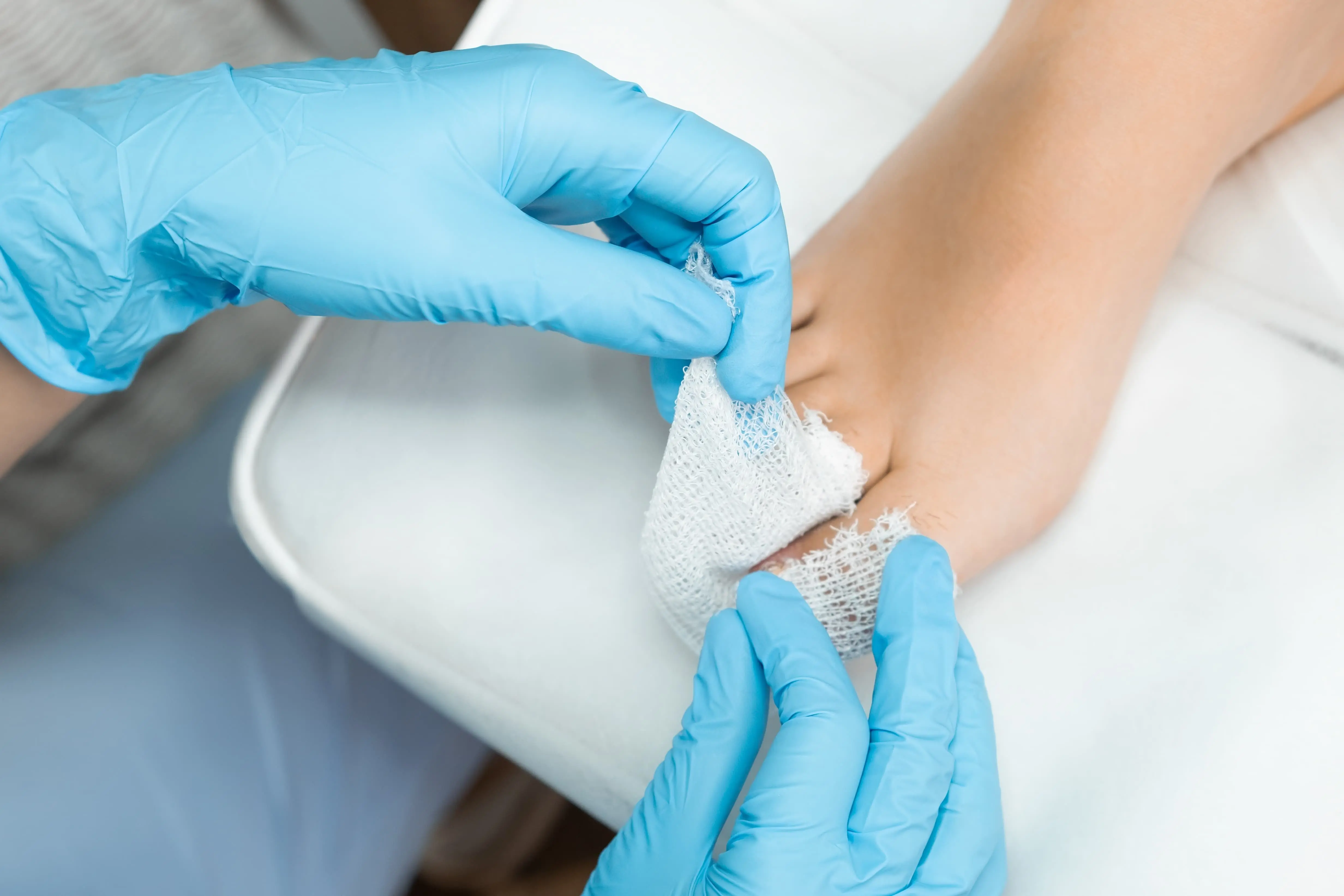 Das Bild zeigt die professionelle Versorgung eines Fußes im Rahmen einer podologischen Behandlung. Eine Fachkraft legt mit sterilen Materialien einen Verband an, um empfindliche oder behandelte Hautstellen zu schützen und die Heilung zu unterstützen. Die Aufnahme steht für hygienische, sorgfältige und medizinisch fachgerechte Fußbehandlung.